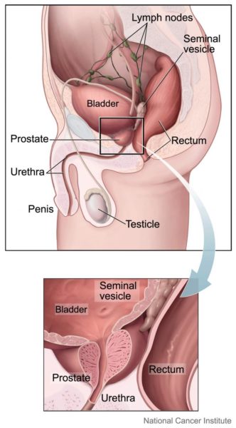 Mi a prostatitis válaszol Krónikus prosztatitis hideg